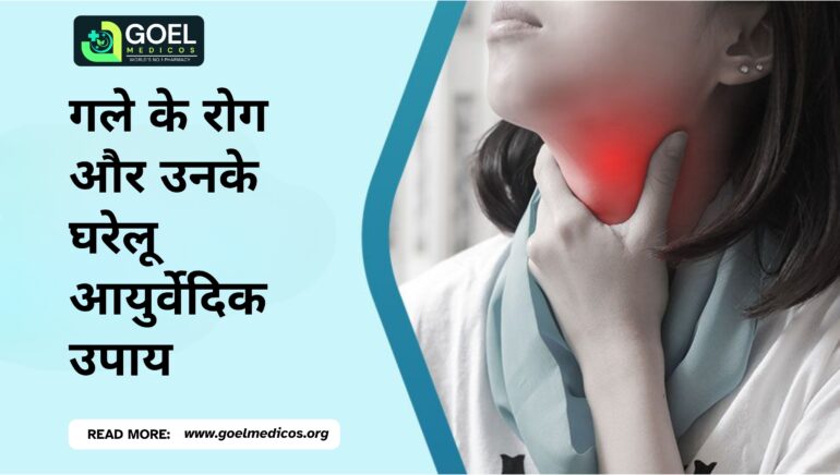Read more about the article गले के रोग और उनके घरेलू आयुर्वेदिक उपाय